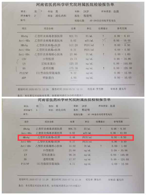 河南郑州治疗乙肝大三阳哪里医院好